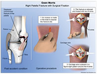 Custom Illustrations